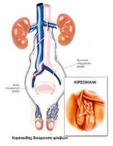 MyDoctors ΓΙΑΤΡΕ ΕΧΩ ΚΙΡΣΟΚΗΛΗ. ΤΙ ΕΙΝΑΙ; ΘΑ ΠΡΕΠΕΙ ΝΑ ΑΝΗΣΥΧΩ; 2 2