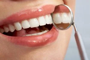 MyDoctors 12 ερωτήσεις για την ορθοδοντική θεραπεία χωρίς σιδεράκια 4 ορθοδοντική