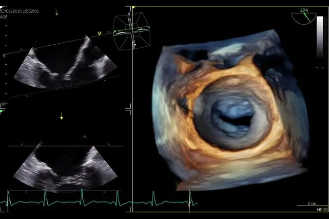 MyDoctors Σύγχρονες Τεχνικές Καρδιολογικών Υπερήχων 1 MyDoctors PAPADOPOYLOS K KEIMENOY ACVI 4