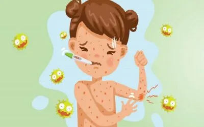 Ιλαρά: Ένας αναδυόμενος κίνδυνος