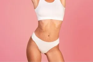 MyDoctors Κοιλιοπλαστική: Όλα όσα πρέπει να γνωρίζουμε 2 MyDoctors shutterstock 2230019823