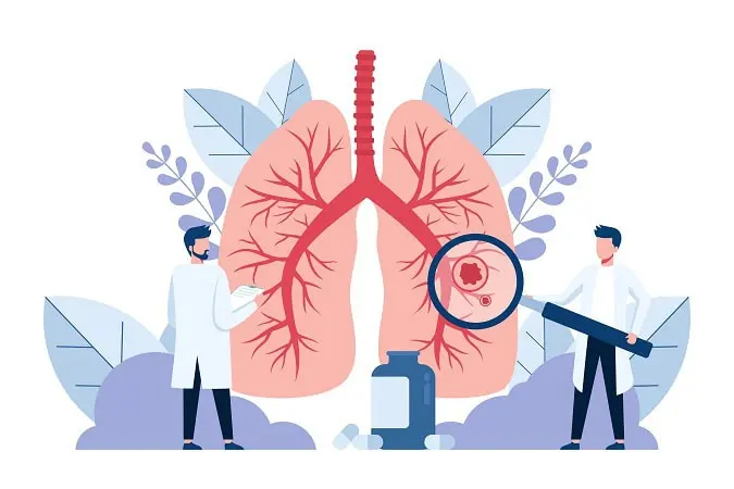 Pulmonology.,Doctors,Examining,Lungs.,Tuberculosis,,Pneumonia,,Lung,Cancer,Treatment,Or