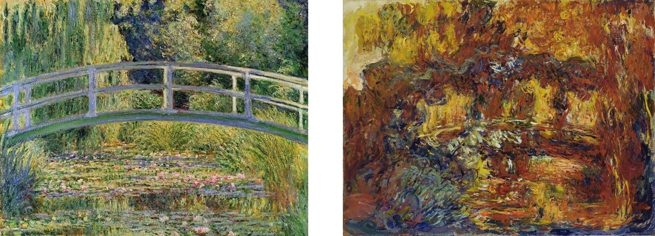 MyDoctors Όταν ο χρόνος θολώνει το φως και η επιστήμη το καθαρίζει ξανά 2 MyDoctors 2 2A