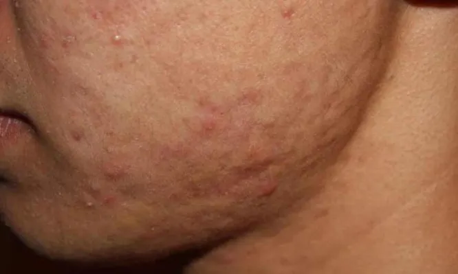 4045a555702d57bfb4076912c4810c16-666x399.jpg