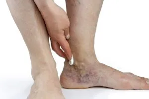 sklhrotherapy-1.jpg