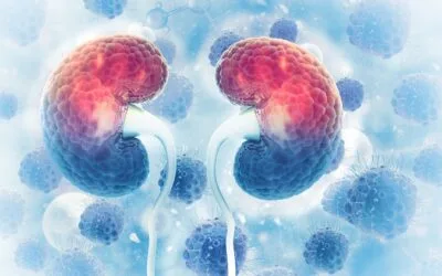 Καρκίνος των νεφρών