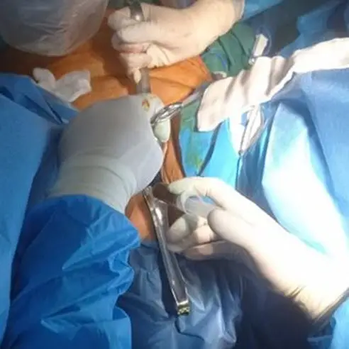 MyDoctors ενδομητριο1