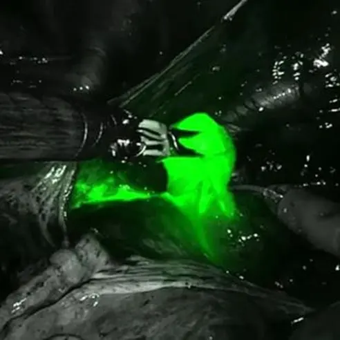 MyDoctors ενδομητριο2