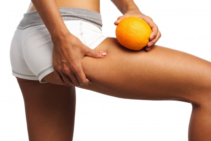 what-causes-cellulite-5.jpg
