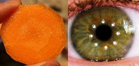 MyDoctors slice carrot eye