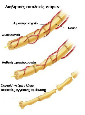 Ποδολογία,Ποδιατρική,Ποδολόγος,Ποδίατρος,Podology,Podiatry,θεραπεία κάλλων, κάλλοι,ποδι