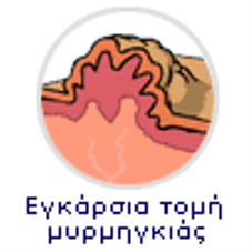 MyDoctors ΜΥΡΜΗΓΚΙΑ 12 tmp634d-2-2.png