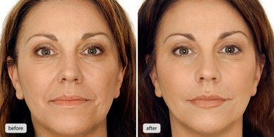 c523cbcd-01_0as05e0as05e000000.jpg c523cbcd-01_0as05e0as05e000000.jpg