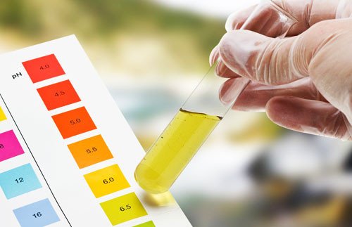 28166394_urine-test.jpg