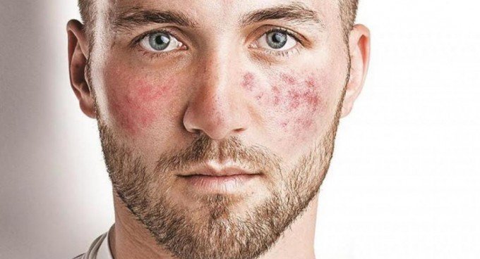 acme1-800×513.jpg acme1-800x513.jpg