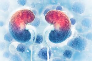 καρκίνος των νεφρών