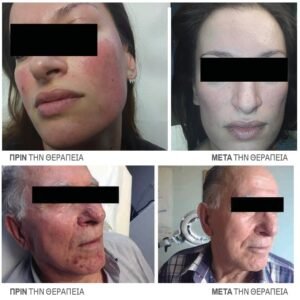 MyDoctors rodoxrous akmi prin meta