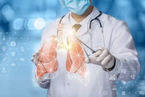 MyDoctors Καρκίνος του Πνεύμονα - Ελάχιστα Επεμβατική Θωρακοχειρουργική 2 Καρκίνος του Πνεύμονα