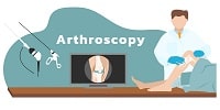 MyDoctors arthroscopy tag min
