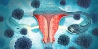MyDoctors ΠΑΘΗΣΕΙΣ 34 MyDoctors gunaikologikos 1 200x100 1