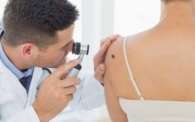 Δερματοσκόπηση σπίλων: Η εξέταση-κλειδί για την έγκαιρη ανίχνευση του καρκίνου του δέρματος