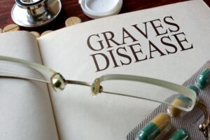 Νόσος Graves