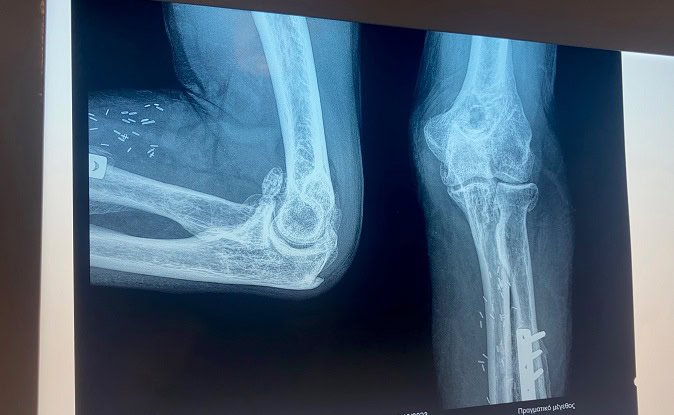 MyDoctors Koukos keimenou 2