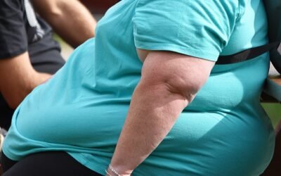 Παχυσαρκία: Η σύγχρονη «πανδημία» – Ο ρόλος της Μεταβολικής Βαριατρικής Χειρουργικής