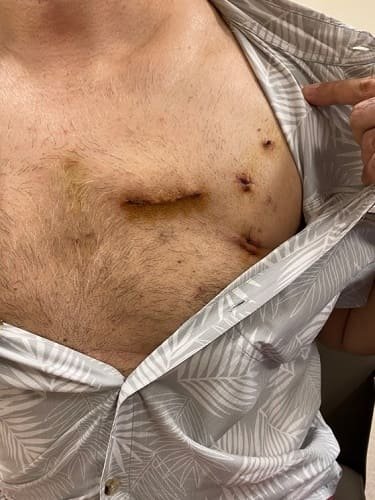 MyDoctors Kofidis asthenis 3