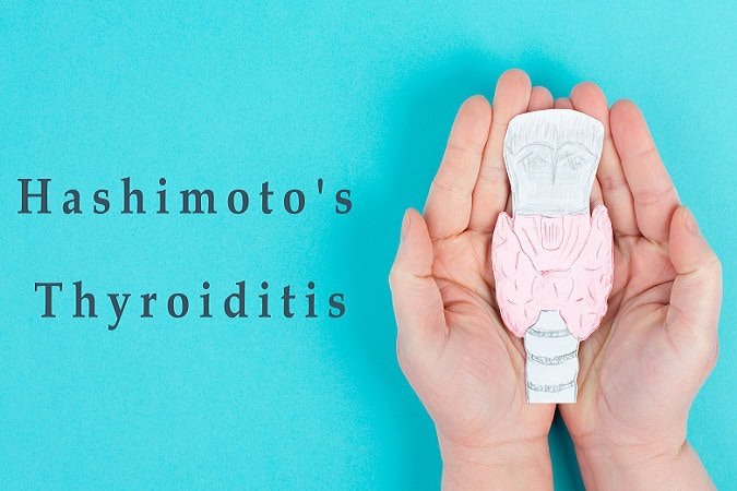 Hashimoto’s,Thyroiditis,,Chronic,Lymphocytic,Disease,,Holding,A,Thyroid,Organ,,Autoimmune