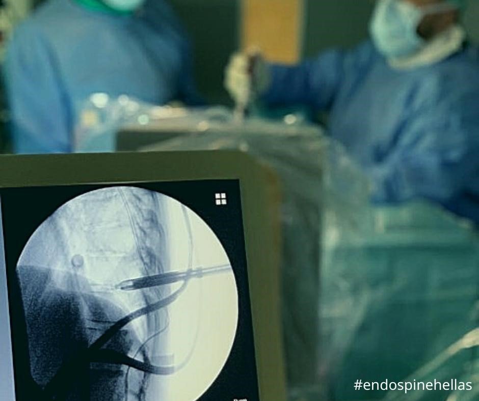 MyDoctors Vastardis 1 endospinehellas4